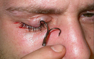 Avoid the Most Common Fishing Accidents & Injuries