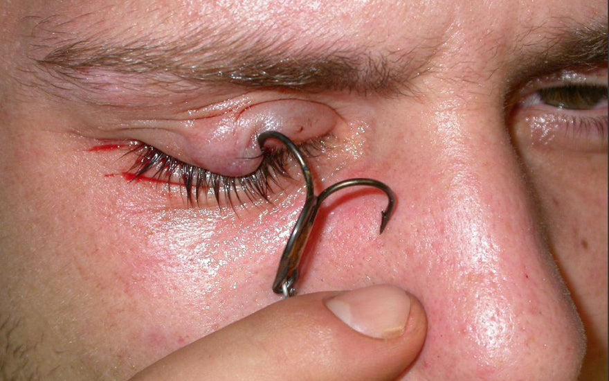 Avoid the Most Common Fishing Accidents & Injuries